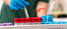 пробирки с кровью для анализов на наркотики